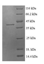 Human C-C motif chemokine 21 (CCL21) Recombinant Protein, N-GST, Homo sapiens (Human), E.coli, N-terminal GST-tagged, 39.3 kDa, purity >≥ 90% as determined by SDS-PAGE.