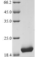 Chicken Avidin (AVD) Recombinant Protein - BioCrest Sci