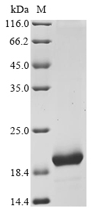 Chicken Avidin (AVD) Recombinant Protein, Gallus gallus (Chicken), Yeast, C-terminal 6xHis-tagged, 15.8 kDa, purity >≥ 85% as determined by SDS-PAGE.
