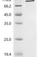 Human Gelsolin (GSN) Recombinant Protein, C-His - BioCrest Sci