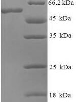 Human Guanine nucleotide-binding protein subunit beta-5 (GNB5) Recombinant Protein - BioCrest Sci