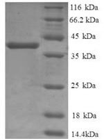 Human Cathepsin D (CTSD), partial Recombinant Protein, N-His - BioCrest Sci