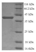 Human Cathepsin D (CTSD), partial Recombinant Protein, N-His, Homo sapiens (Human), E.coli, N-terminal 6xHis-tagged, 40.8 kDa, purity >≥ 90% as determined by SDS-PAGE.