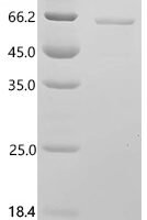 Human Leucine-rich repeat protein SHOC-2 (SHOC2), partial Recombinant Protein - BioCrest Sci