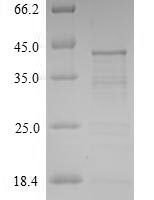 Tachypleus tridentatus Tachylectin-2 Recombinant Protein - BioCrest Sci