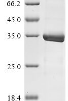 Human Histone H4 (H4C1), partial Recombinant Protein - BioCrest Sci