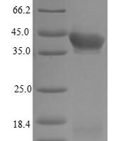 Human Estrogen receptor beta (ESR2) Recombinant Protein, N-His - BioCrest Sci