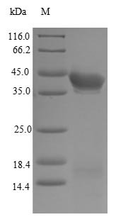 Human Estrogen receptor beta (ESR2) Recombinant Protein, N-His, Homo sapiens (Human), E.coli, N-terminal 6xHis-tagged, 39.8 kDa, purity >>85% as determined by SDS-PAGE.