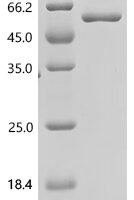 Mouse Hexokinase-2 (Hk2), partial Recombinant Protein, C-His, aa 16–458, E.coli - BioCrest Sci