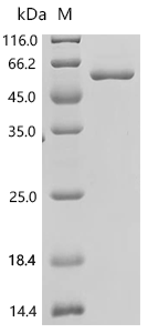 Mouse Hexokinase-2 (Hk2), partial Recombinant Protein, C-His, aa 16–458, E.coli, Mus musculus (Mouse), E.coli, C-terminal 6xHis-tagged, 56.6 kDa, purity >≥ 95% as determined by SDS-PAGE.