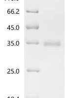 Plasmodium falciparum Thrombospondin-related anonymous protein (TRAP), partial Recombinant Protein, C-His, aa 26–287, Baculovirus - BioCrest Sci