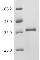 Macaca fascicularis tumor-associated calcium signal transducer 2 (TACSTD2), partial Recombinant Protein - BioCrest Sci