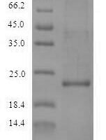 Callithrix jacchus Interleukin-10 (IL10) Recombinant Protein - BioCrest Sci