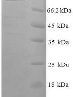 Human Protein FAM160B1 (FAM160B1) Recombinant Protein - BioCrest Sci