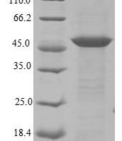 Rat Heat-stable enterotoxin receptor (Gucy2c), partial Recombinant Protein, N-His/C-Myc, aa 23–429, E.coli - BioCrest Sci