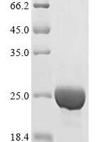 Human Sulfiredoxin-1 (SRXN1), partial Recombinant Protein - BioCrest Sci