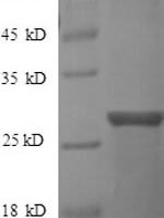 Human GTPase ERas (ERAS), partial Recombinant Protein - BioCrest Sci