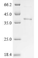 Human herpesvirus 2 Envelope glycoprotein H (gH), partial Recombinant Protein - BioCrest Sci