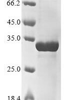 Mouse Secreted phosphoprotein 24 (Spp2) Recombinant Protein, N-10His/C-Myc - BioCrest Sci