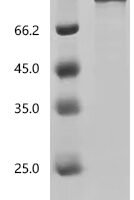 Rat Heat shock protein HSP 90-alpha (Hsp90aa1) Recombinant Protein, C-10His, aa 2–733, Baculovirus - BioCrest Sci