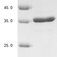 Human DNA (cytosine-5)-methyltransferase 3A (DNMT3A) Recombinant Protein - BioCrest Sci