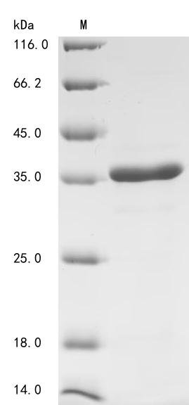 Human DNA (cytosine-5)-methyltransferase 3A (DNMT3A) Recombinant Protein, Homo sapiens (Human), E.coli, N-terminal 10xHis-tagged and C-terminal Myc-tagged, 24.3 kDa, purity >≥ 90% as determined by SDS-PAGE.