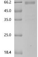 Human Sclerostin domain-containing protein 1 (SOSTDC1) Recombinant Protein, C-mFc2a - BioCrest Sci
