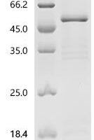 Mouse Indian hedgehog protein (Ihh), partial Recombinant Protein, N-hFc1 - BioCrest Sci