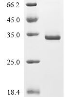 Mouse Endothelin-3 (Edn3), partial Recombinant Protein - BioCrest Sci
