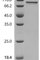 Plasmodium falciparum Merozoite surface protein 1 (MSP1), partial Recombinant Protein, N-His - BioCrest Sci