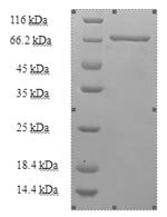 Human Kynurenine--oxoglutarate transaminase 3 (CCBL2) Recombinant Protein, Homo sapiens (Human), E.coli, N-terminal 6xHis-SUMO-tagged, 67.4 kDa, purity >≥ 90% as determined by SDS-PAGE.