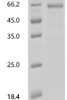 Human Disintegrin and metalloproteinase domain-containing protein 22 (ADAM22), partial Recombinant Protein - BioCrest Sci