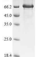 Human Cysteine-rich secretory protein LCCL domain-containing 1 (CRISPLD1) (G371D) Recombinant Protein - BioCrest Sci