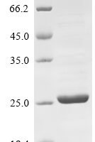Mouse Ras-related protein Rab-44 (Rab44), partial Recombinant Protein - BioCrest Sci