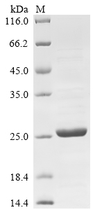 Mouse Ras-related protein Rab-44 (Rab44), partial Recombinant Protein, Mus musculus (Mouse), E.coli, N-terminal 10xHis-tagged and C-terminal Myc-tagged, 24.5 kDa, purity >≥ 85% as determined by SDS-PAGE.