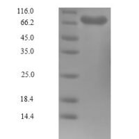 Human Serine/threonine-protein kinase PLK1 (PLK1) Recombinant Protein - BioCrest Sci