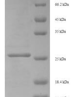 Human Eukaryotic translation initiation factor 4E-binding protein 3 (EIF4EBP3) Recombinant Protein - BioCrest Sci