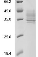 Human Tumor necrosis factor receptor superfamily member 13C (TNFRSF13C)(P21L), partial Recombinant Protein - BioCrest Sci