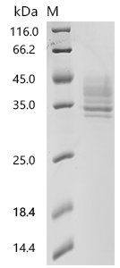 Human Tumor necrosis factor receptor superfamily member 13C (TNFRSF13C)(P21L), partial Recombinant Protein, Homo sapiens (Human), Mammalian cell, C-terminal hFc1-tagged, 36.1 kDa, purity >≥ 95% as determined by SDS-PAGE.