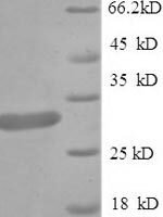 Crotalus adamanteus Thrombin-like enzyme crotalase Recombinant Protein - BioCrest Sci