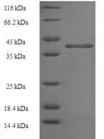 Human N (6)-adenine-specific DNA methyltransferase 2 (N6AMT2) Recombinant Protein - BioCrest Sci