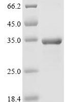 Mouse Glutathione-specific gamma-glutamylcyclotransferase 1 (Chac1) Recombinant Protein - BioCrest Sci