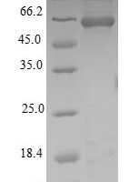 Wuchereria bancrofti Putative serine protease inhibitor Recombinant Protein - BioCrest Sci
