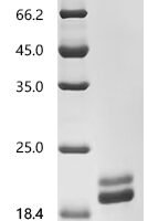 Human Interleukin-2 (IL-2), Biotinylated Recombinant Protein - BioCrest Sci