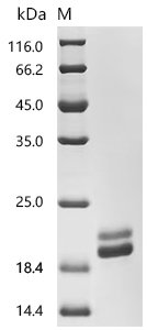 Human Interleukin-2 (IL-2), Biotinylated Recombinant Protein, Homo sapiens (Human), Mammalian cell, C-terminal 10xHis-Avi-tagged, 18.9 kDa, purity >≥ 95% as determined by SDS-PAGE.≥ 95% as determined by SEC-HPLC.