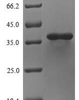 Staphylococcus aureus Phospholipase C (hlb) Recombinant Protein, N-10His - BioCrest Sci