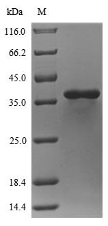 Staphylococcus aureus Phospholipase C (hlb) Recombinant Protein, N-10His, Staphylococcus aureus (strain MRSA252), Yeast, N-terminal 10xHis-tagged, 36.2 kDa, purity >≥ 90% as determined by SDS-PAGE.