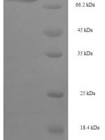 Human Cytochrome P450 4F11 (CYP4F11), partial Recombinant Protein - BioCrest Sci