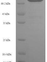 Human Keratin, type II cytoskeletal 1b (KRT77) Recombinant Protein - BioCrest Sci