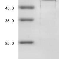 Human Beclin-1 (BECN1) Recombinant Protein - BioCrest Sci